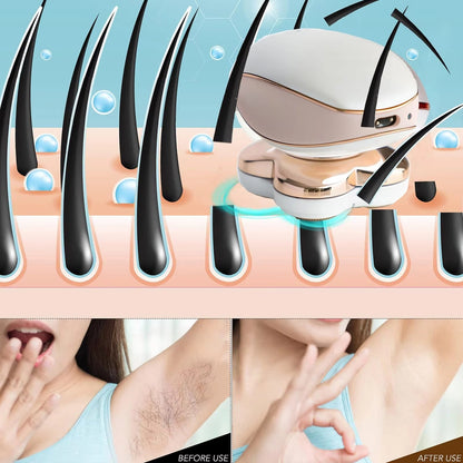 Hair Remover Foot &amp; Body