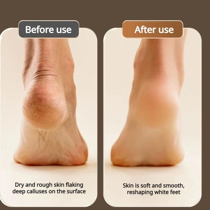 Rechargeable Digital Foot Grinder